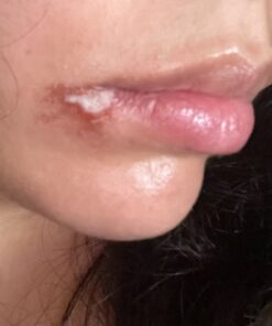 Terrasil Wound Care - 3X Faster Healing, Infection Protection Ointment for bed sores, pressure sores, diabetic wounds, ulcers, cuts, scrapes, and burns (14 gram tube) 40 81 oUkWFUL