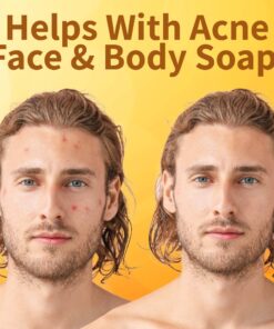 O Naturals Organic African Black Soap Bar 3PC - Rich in African Shea Butter - Helps Acne Prone Skin - Natural Body & Face Wash - Natural Black Soap Bar for Women & Men 9 811rlbPbBL