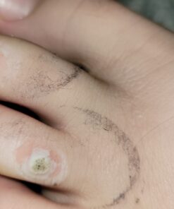 Compound W Maximum Strength One Step Plantar Wart Remover Foot Pads, 20 Count 20 Count (Pack of 1) 59 8122gAECTPL