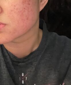 Obagi Medical CLENZIderm M.D. System Pack of 1 23 812mJgFuZ0L