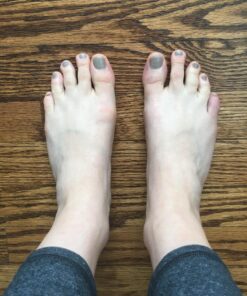ZenToes Gel Toe Separators for Overlapping Toes, Bunions, Big Toe Alignment, Corrector and Spacer - 4 Pack (Beige) Beige 40 813yzzy3b3L