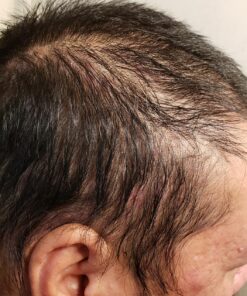 artnaturals Argan Hair Growth Shampoo - (16 Fl Oz / 473ml) - Sulfate Free - Treatment for Hair Loss, Thinning & Regrowth - Men & Women - Infused with Biotin, Argan Oil, Keratin, Caffeine 42 814PKCmoS7L