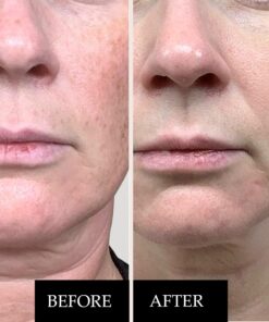 Alternative view of Kleem Organics Pure Vitamin C Serum for Face with Hyaluronic Acid & Vitamin E - Anti Aging Vitamin C Face Serum for Women to Boost Collagen, Reduce Wrinkle, Acne, Dark Spot & Sun Damage - Vit C Serum 1 Fl Oz (Pack of 1)