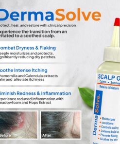 Dermasolve 4 oz Psoriasis, Seborrheic Dermatitis, & Dandruff Scalp Oil 2 Pack | Dermatologist Approved | Flaky Scalp Relief | Clinically Tested, Long-Lasting Itch-Free, High-Performance Formula 4 Ounce (Pack of 2) 15 817h0f1 K0L