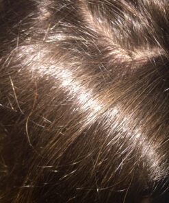 Head and Shoulders Clinical Strength Dandruff and Seborrheic Dermatitis Shamp 13.5 Fl Oz(Pack of 2) 25 818lj3ykBRL