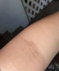 Tea Tree Oil Balm , Extra Strength, Pair Well with Jock Itch Cream, Spray, Athletes Foot, Ringworm Cream for Human, Fast Acting for Dry, Itchy Skin, Plant Powered Wonder Balm 46 819chhOS7lL