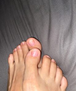 Toenail Renewal Solution Extra Strength Care for Toe Nail & Fingernails - Nail Repair Solution for Thick, broken, Discolored Nails - Renews Damaged Cracked Ingrown Toenail - Tea Tree Oil for Healthier and Extra Strength Nails - Made In USA 0.50 Fl Oz 49 819wPSl7vbL