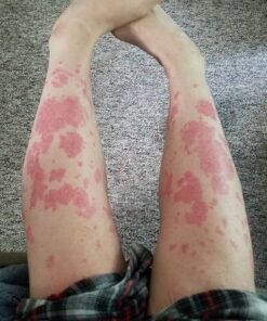 Black Seed Oil - 120 Softgel Capsules Skin Health (Non-GMO & Vegan) Cold-Pressed Nigella Sativa Producing Pure Black Cumin Seed Oil with Vitamin E - 500mg Each, 1000mg Per 2 Capsule Serving Capsules (120 Count) 32 81CJQTLtWtL