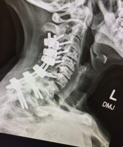 Aduro Sport Weighted Vest Workout Equipment, 4lbs/6lbs/12lbs/20lbs/25lbs/30lbs Body Weight Vest for Men, Women, Kids 6 Pounds (2.72 KG) 22 81DYgFomYuL