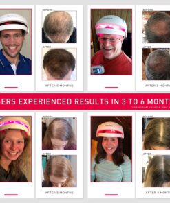 iRestore Essential Laser Hair Growth System - FDA Cleared Hair Loss Treatments for Men & Women & Hair Growth Products for Men with Thinning Hair, Hair Regrowth Treatments Laser Cap, Red Light Therapy 32 81GW8MNelnS