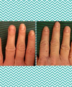 ASPEN NATURALS Collagen Peptides Powder Supplement. Unflavored Grass Fed Hydrolyzed Collagen Powder for Skin Hair Nail Joint. Dairy & Gluten Free. Paleo Friendly Protein Powder for Women & Men. 24 oz 1.5 Pound (Pack of 1) 21 81H 046rrL