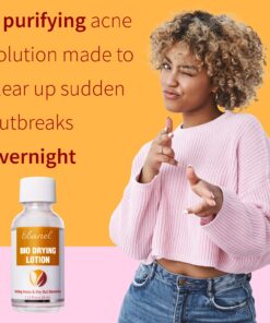 Ebanel Acne Drying Lotion, Overnight Salicylic Acid and Sulfur Cystic Acne Spot Treatment for Face and Body, Pimple Cream Spot Treatment, Dries Out Pimples, Cysts, Blemishes, Zits, and Clogged Pores 25 81HeOqukghL