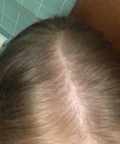 DrFormulas HairOmega DHT Blocker Biotin 5000 mcg Vitamins for Hair Growth Supplement | Hair Loss Pills for Women and Men, 30 Day Supply 60 Count (Pack of 1) 24 81I3BEwYsfL