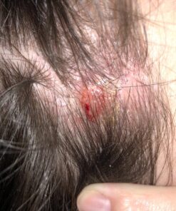 Tea Tree Shampoo and Conditioner Set - Sulfate Free Clarifying Shampoo and Conditioner for Oily Hair & Scalp Care with Australian Tea Tree Oil - Complete Dry Scalp Treatment for Build Up (8 Fl Oz) 8 Fl Oz (Pack of 2) 30 81Iz6MXLpL