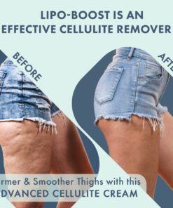 WeightLoss-Solutions Lipo-Boost Cellulite Cream with Caffeine is an Advanced Firming Lotion for Thighs and Butt, Stomach, Belly, Breasts, and Arms, to Smooth, Firm, Tone, and Tighten 12 81K4KA6QNRL