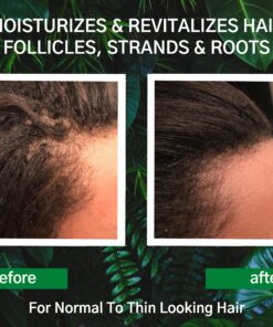 Hair Growth Conditioner - Hair Loss Conditioner For Thinning Hair - Sulfate Free Prevention Formula Against Hair Loss, Alopecia & Receding Hairline with Argan Oil - by Amplixin 23 81KSxLrOGgL