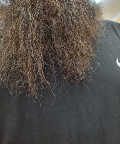 Nizoral Anti-Dandruff Shampoo with 1% Ketoconazole, Fresh Scent, 7 Fl Oz 47 81LpMzuvxxL