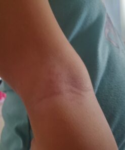 Cortizone 10 Maximum Strength Plus Ultra Moisturizing Anti-Itch Cream, 1% Hydrocortisone, 2 oz. Old Packaging 21 81LzBnAHCiL