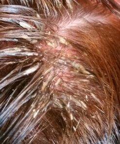 Radha Beauty Eucalyptus Essential Oil 4 oz - 100% Pure & Therapeutic Grade, Steam Distilled for Aromatherapy, Relaxation, Shower, Sauna, Bath, Steam Room and other DIY Projects. 4 Fl Oz (Pack of 1) 34 81ORWKyEdWL 3