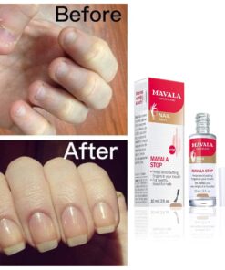 Mavala Stop Deterrent Nail Polish Treatment | Nail Care to Help Stop Putting Fingers In Your Mouth | Bitter Taste | Easy Application | For Ages 3+ | 0.3 Fl Oz 0.3 Fl Oz (Pack of 1) 34 81PX5neEfKL