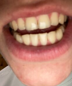 JINAO 18K Gold Plated Gold Finish 8 Top Teeth 8 Bottom Tooth Hip Hop Mouth Grills for Men and Women Gold Set 21 81QQozCNxXL