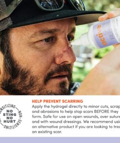 Active Skin Repair First Aid Scar Shield Hydrogel - Scar Treatment for Cuts, Scrapes, Burns and Other Wounds to Stop Scars BEFORE They Form - Natural and Non-Toxic Scar Prevention Gel (3 oz Gel) 18 81RJsIV6vzL