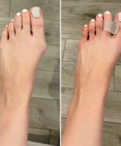 Toe Spacers for Men and Women – 4 Gel Toe Separators, Hammer Toe Straightener, Correct Toes, by 5 Stars United Big 4 Pack 35 81TPa5676GL