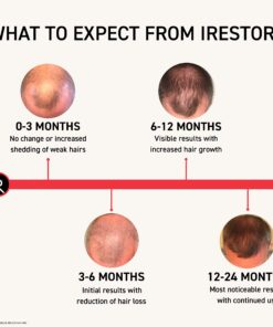 iRestore Essential Laser Hair Growth System - FDA Cleared Hair Loss Treatments for Men & Women & Hair Growth Products for Men with Thinning Hair, Hair Regrowth Treatments Laser Cap, Red Light Therapy 33 81UEwN1kfxL