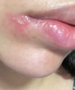 Terrasil Wound Care - 3X Faster Healing, Infection Protection Ointment for bed sores, pressure sores, diabetic wounds, ulcers, cuts, scrapes, and burns (14 gram tube) 41 81Utnjs8bqL