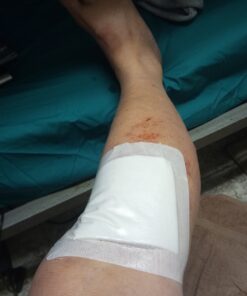 Dynarex 3036 DynaGuard Waterproof Dressing, Sterile, Four-Layer Composite Dressing, 6" x 6", Pack of 10 10 Count/6 X 6 Inch 1 17 81V8LLgq5cL