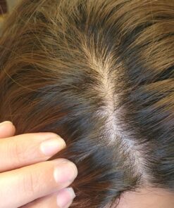 Nizoral Anti-Dandruff Shampoo with 1% Ketoconazole, Fresh Scent, 7 Fl Oz 54 81XjKDnVqL