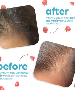 Artnaturals Biotin Gummies for Hair Growth - (100 Gummies - 10000mcg) - Natural Strawberry Vitamins Supports Nails and Skin - Gelatin, Gluten, Nut and Egg Free 16 81YlBrEuaL