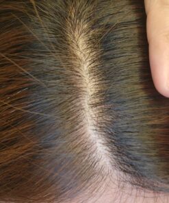 Nizoral Anti-Dandruff Shampoo with 1% Ketoconazole, Fresh Scent, 7 Fl Oz 55 81a9BPkr60L