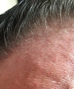 Nourish Beaute Hair Regrowth Treatment Serum for Hair Loss, Volume and Thickening with Caffeine for Men and Women, 1.7 Oz 31 81aJmnWWrKL