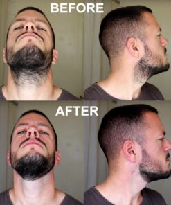 Aberlite FlexShaper - Beard Shaper Neckline Guide - Hands-Free & Flexible, The Ultimate Shaping Template, Trimmer, Lineup Stencil Kit beard liner tool outliner (White) White 25 81auB02Cc5L