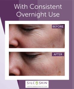 SilcSkin Silicone Eye Pads for Fine Lines, Crepey Skin, and Puffiness - Reusable Overnight Face Pads - 1 Pack 6 Count (Pack of 1) 8 81cXvebiWdL