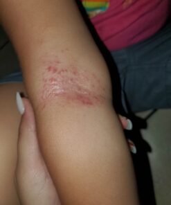 Cortizone 10 Maximum Strength Plus Ultra Moisturizing Anti-Itch Cream, 1% Hydrocortisone, 2 oz. Old Packaging 22 81cpktUp3uL