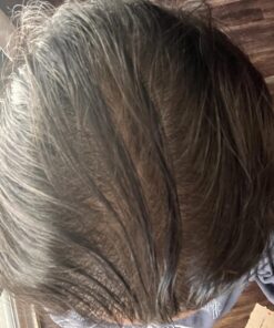 DHT BLOCKER - Hair Growth Supplement for Genetic Thinning for Men and Women | Approved* by American Hair Loss Association | Guaranteed, Backed by 20 Years of Experience in Hair Loss Treatment Clinics 70 81cpqz7MVuL