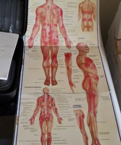 Trigger Points (Quick Study Academic) Pamphlet, Illustrated 21 81cxA1h862L