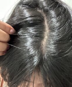 Nizoral Anti-Dandruff Shampoo with 1% Ketoconazole, Fresh Scent, 7 Fl Oz 65 81fL5TrPKDL