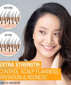 Neutrogena Scalp Therapy Anti-Dandruff Shampoo Extra Strength, with 3% salicylic acid, Fragrance Free, 12 fl oz 12 81geHlSB16L