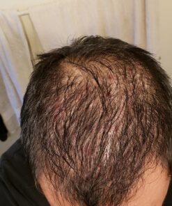 artnaturals Argan Hair Growth Shampoo - (16 Fl Oz / 473ml) - Sulfate Free - Treatment for Hair Loss, Thinning & Regrowth - Men & Women - Infused with Biotin, Argan Oil, Keratin, Caffeine 43 81gwPdEU8VL