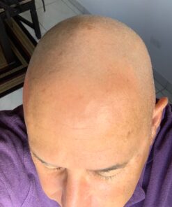 Bee Bald SMOOTH PLUS Daily Moisturizer With SPF 30 Broad Spectrum Sunscreen - Head and Face Moisturizer Lotion for Men and Women Too - Hydrate and Protect Skin from Harmful UVA/UVB Rays - 1.7 fl Oz 19 81hPYmzaNoL