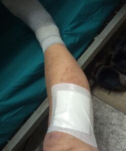 Dynarex 3036 DynaGuard Waterproof Dressing, Sterile, Four-Layer Composite Dressing, 6" x 6", Pack of 10 10 Count/6 X 6 Inch 1 18 81hvYlNVHL