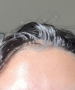 DHT BLOCKER - Hair Growth Supplement for Genetic Thinning for Men and Women | Approved* by American Hair Loss Association | Guaranteed, Backed by 20 Years of Experience in Hair Loss Treatment Clinics 71 81ij77L9sIL