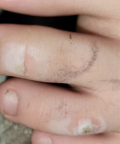 Compound W Maximum Strength One Step Plantar Wart Remover Foot Pads, 20 Count 20 Count (Pack of 1) 61 81j1Lk BtFL