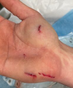 SilverSeal Burn and Wound Dressing | Hydrogel Pads with X-Static Silver | Soothing, Moist & Protective | Burns, Cuts & Wounds | 4 Sterile Dressings 4"x4" Patch (4 Count) 75 81kMBiJy33L