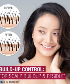 Neutrogena Scalp Therapy Anti-Dandruff Shampoo for Scalp Build-up Control, 2.5% salicylic acid, with Apple Cider Vinegar Fragrance, 12 fl oz 12 81lOLImHQbL