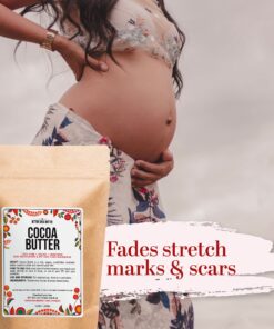 Better Shea Butter Raw Cocoa Butter - Unrefined, 100% Pure, Food Grade - Use for Cocoa Lip Balm, Stretch Marks Cream, Cacao Butter Cream, Scars Oil, Whipped Lotion - Skin & Hair Moisturizer 8 oz Block Bar 8 Ounce (Pack of 1) 27 81lQqQ zNVL