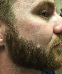 Beard Shaping Tool Razor Mustache - Straight Edge Travel Razors For Bags Grooming Kit Blade Trimmer For Men After Black Color Dye Balm Oil Wash Replacement Disposable Stainless Steel Eyebrow Clippers 60 81lh7pKJPQL